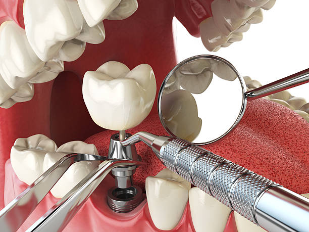 Best Emergency Dentist Near Me  in Daleville, VA